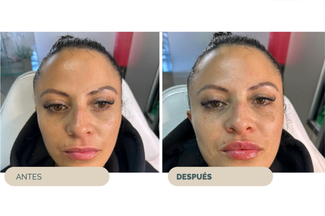 RENOVA CLINIC URUGUAY